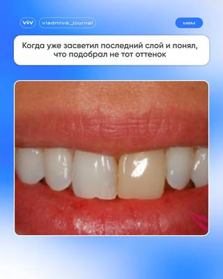 Улыбка после мема — повод для реминерализации.
